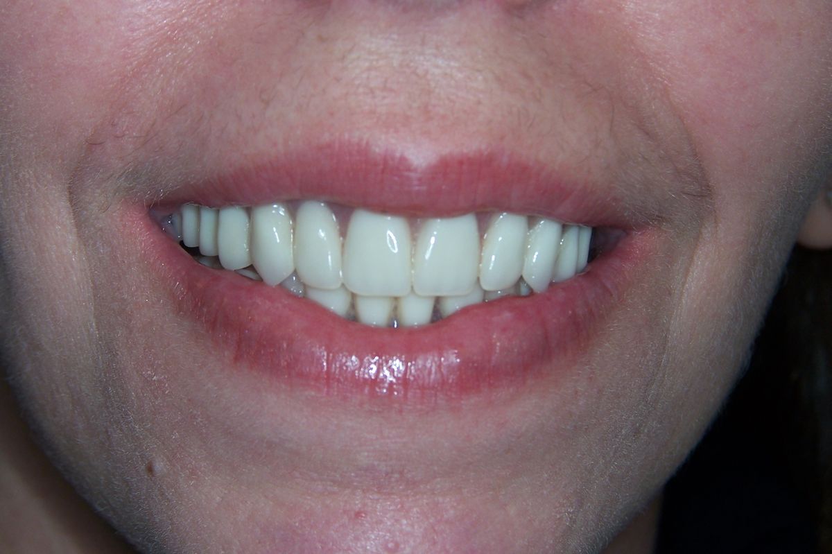 Gallery Country Club Dental Care